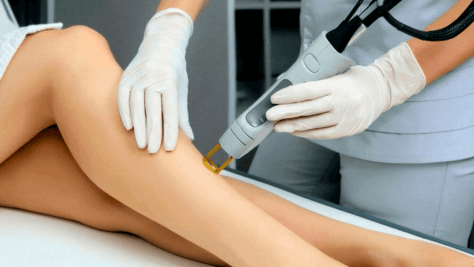 a-review-of-severe-and-recurrent-urticaria-after-laser-hair-removal-apan